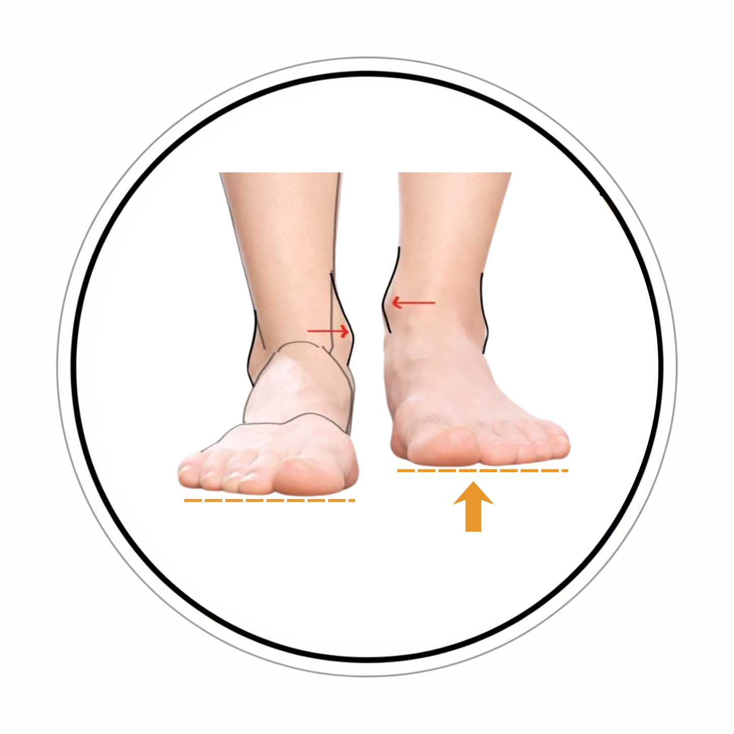 Beinlängendifferenz & Beckenschiefstand